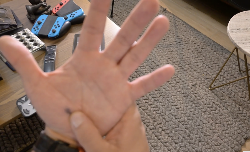 Hallazgo de la UNAM, clave para conocer el desarrollo del cáncer de piel en México