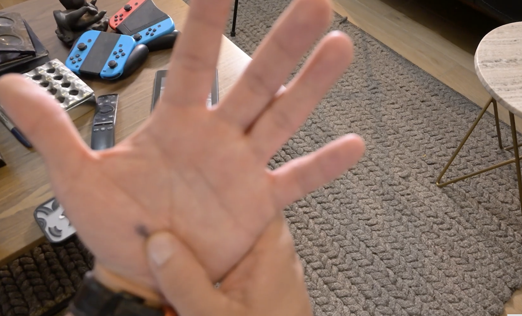 Hallazgo de la UNAM, clave para conocer el desarrollo del cáncer de piel en México