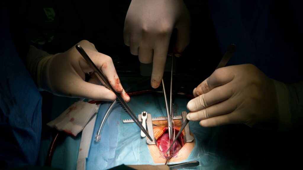 Pacientes trasplantadas piden combatir tabúes que frenan la donación de órganos en México