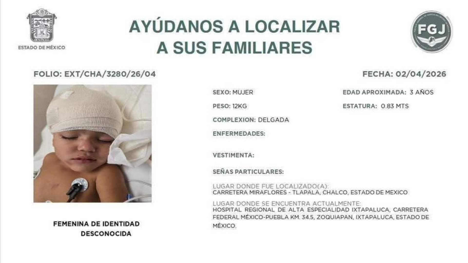 Niña de 3 años permanece hospitalizada en calidad de no identificada, tras accidente en Chalco Niña de 3 años permanece hospitalizada en calidad de no identificada, tras accidente en Chalco