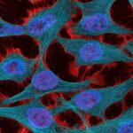 La estrategia de teragnosis contra el cáncer avanza en México hacia etapas tempranas
