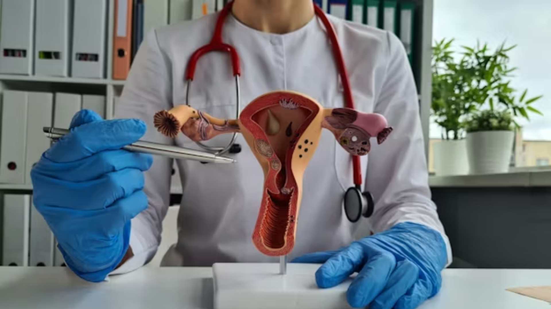 Campaña busca reducir brechas en cáncer cervicouterino, prevenible en 99.7 % en México