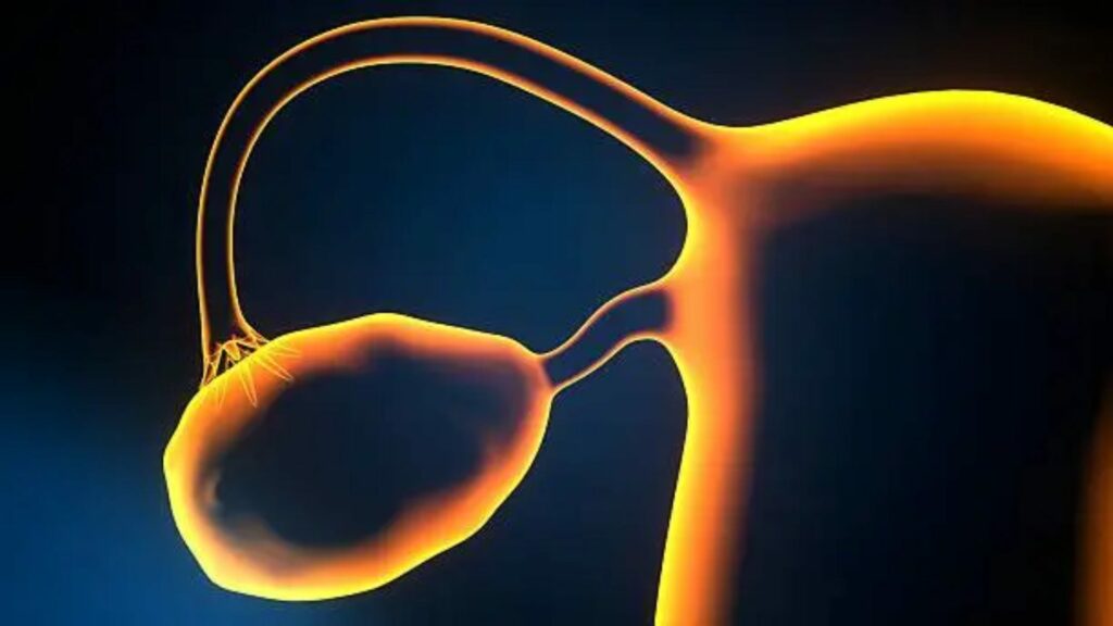 Asociación mexicana pide priorizar la atención del cáncer de ovario - asociacion-mexicana-pide-priorizar-la-atencion-del-cancer-de-ovario-1-1024x576