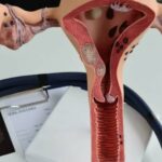 Asociación mexicana pide priorizar la atención del cáncer de ovario