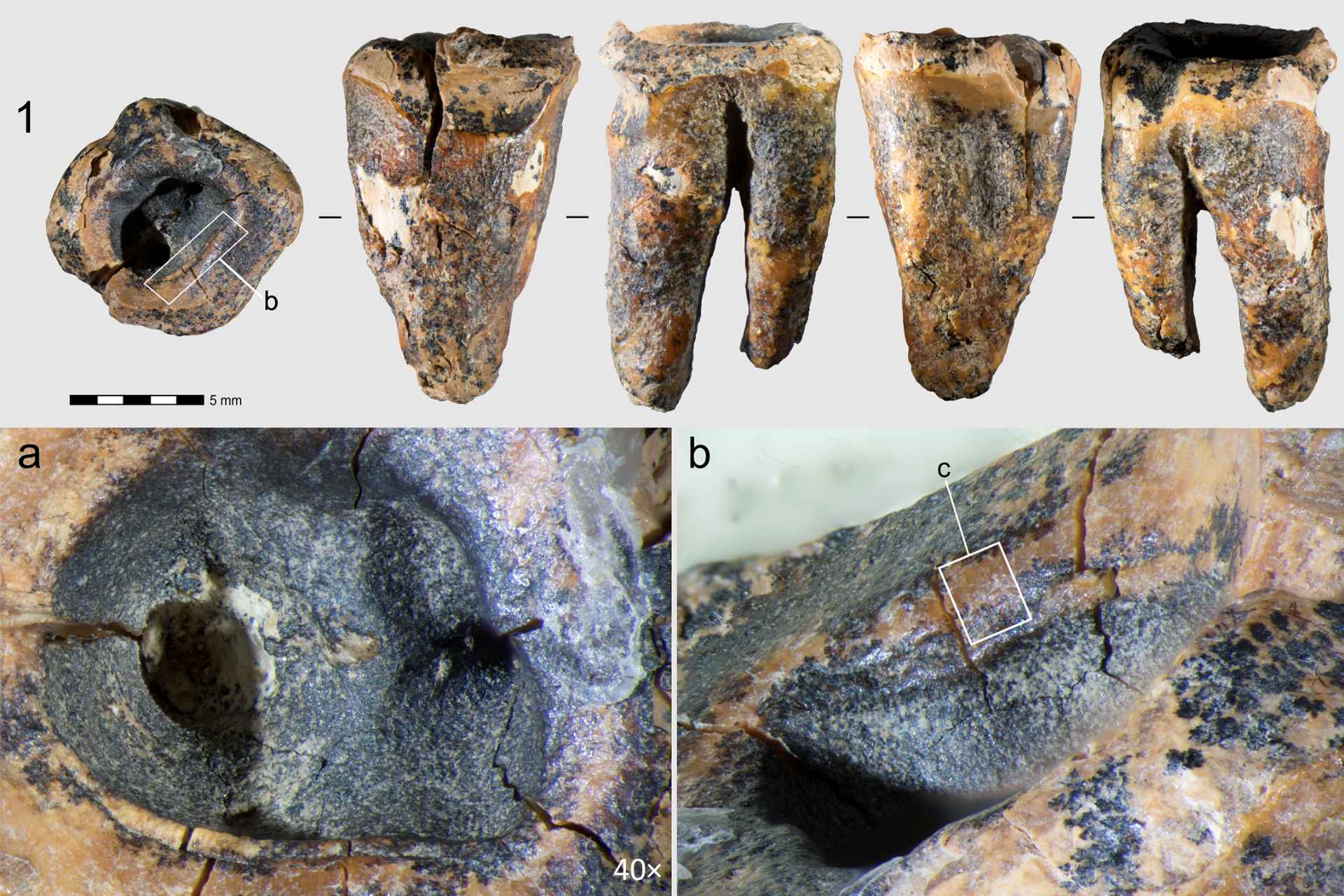 Neandertales trataban caries usando herramientas de piedra hace 60 mil años