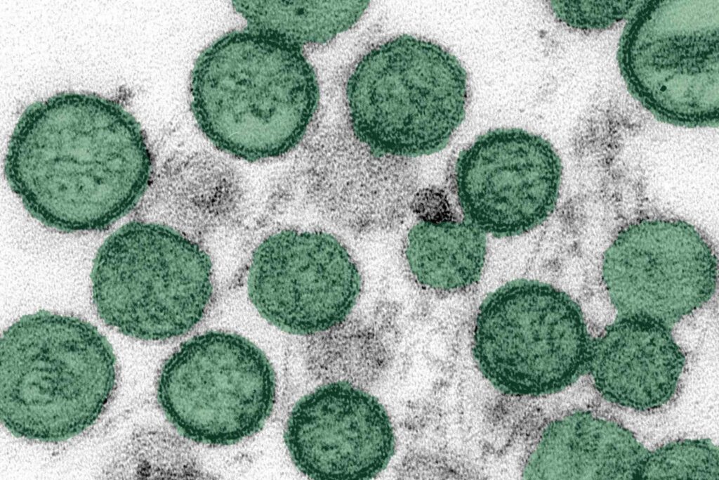¿Brote de hantavirus en un crucero puede convertirse en una epidemia? OMS responde