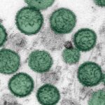 ¿Brote de hantavirus en un crucero puede convertirse en una epidemia? OMS responde