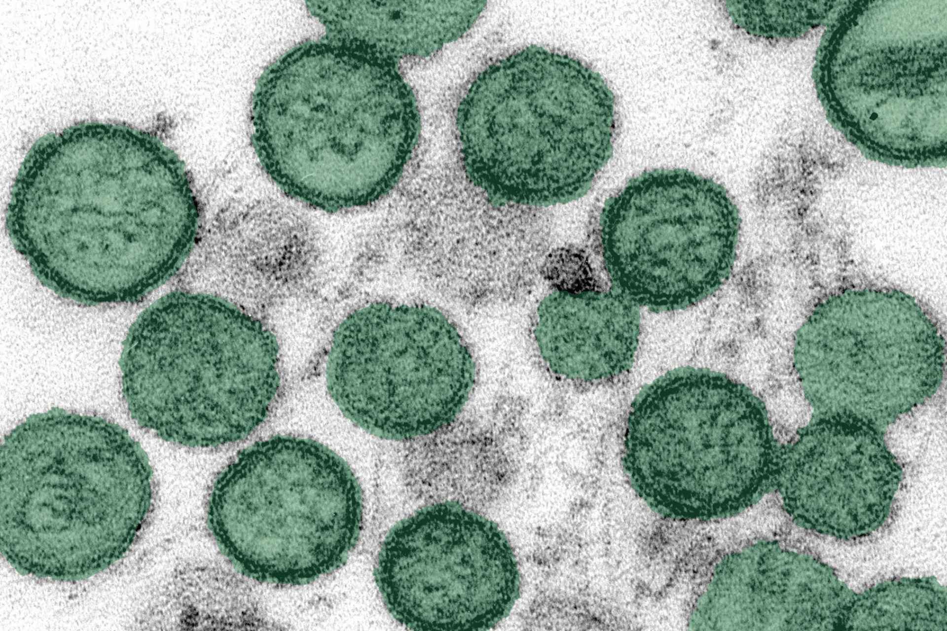 ¿Brote de hantavirus en un crucero puede convertirse en una epidemia? OMS responde