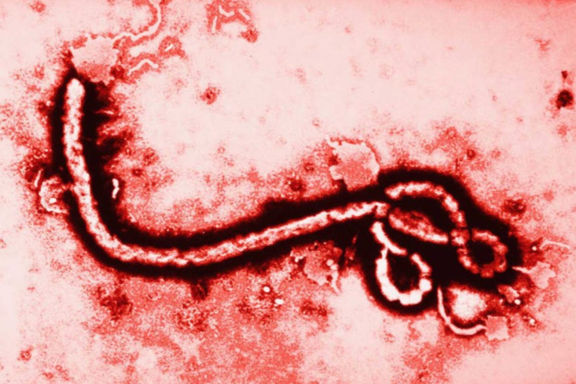 México sin casos de ébola; Secretaría de Salud refuerza vigilancia ante brote México sin casos de ébola; Secretaría de Salud refuerza vigilancia ante brote