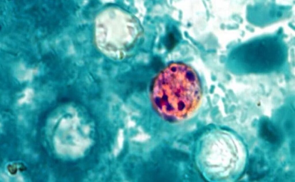 Casos de ciclosporiasis aumentan en Estados Unidos; ¿qué es, cuáles son sus síntomas y cómo prevenirla?