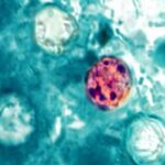 Casos de ciclosporiasis aumentan en Estados Unidos; ¿qué es, cuáles son sus síntomas y cómo prevenirla?