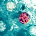 México reporta tres casos de Cyclospora, ¿hay brote de la enfermedad?