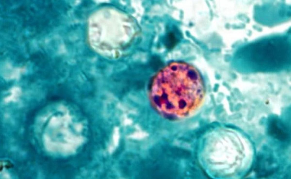 México reporta tres casos de Cyclospora, ¿hay brote de la enfermedad? México reporta tres casos de Cyclospora, ¿hay brote de la enfermedad?
