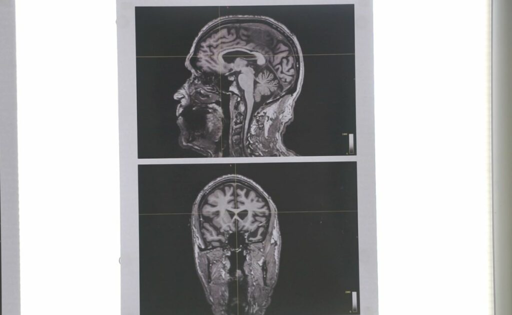 ¿El arte beneficia a nuestro cerebro? ¿El arte beneficia a nuestro cerebro?