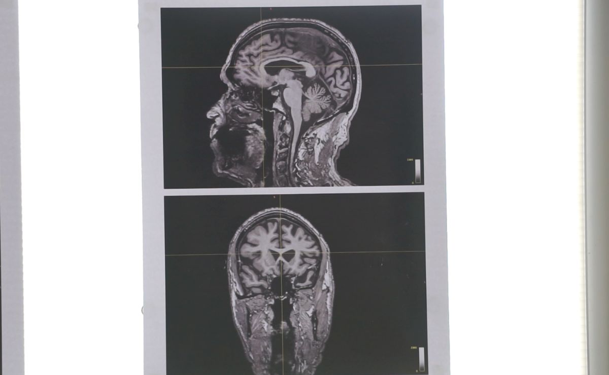 ¿El arte beneficia a nuestro cerebro? ¿El arte beneficia a nuestro cerebro?