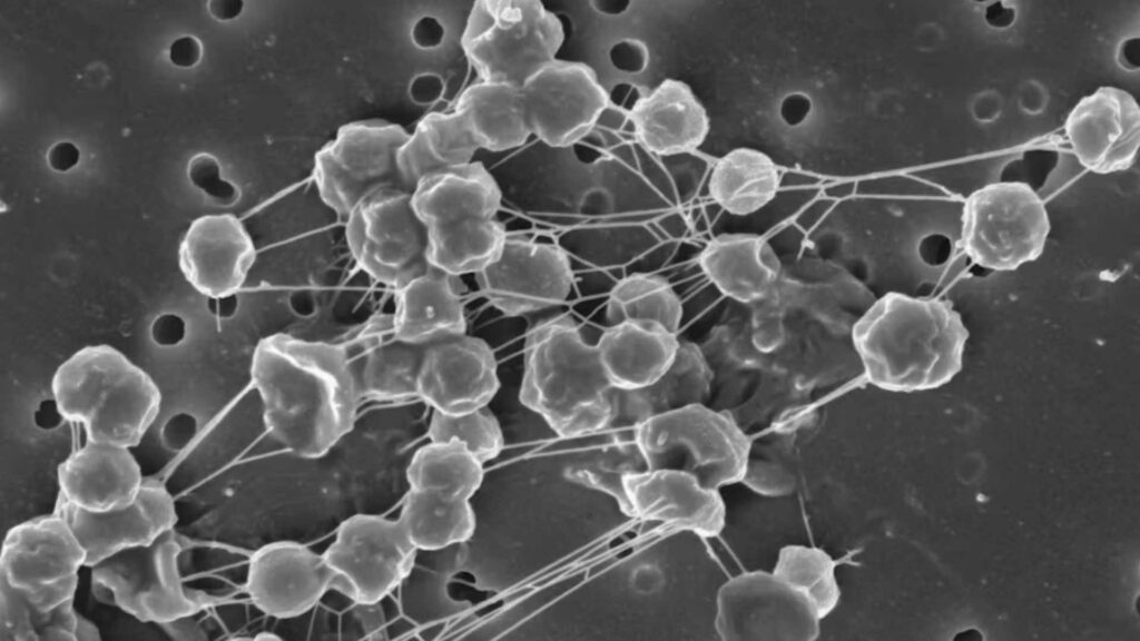 La NASA alerta del riesgo de que los microbios humanos contaminen el polo sur de la Luna - la-nasa-alerta-del-riesgo-de-que-los-microbios-humanos-contaminen-el-polo-sur-de-la-luna-1024x576
